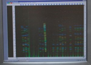 Na zdjęciu widok monitora z profilem DNA